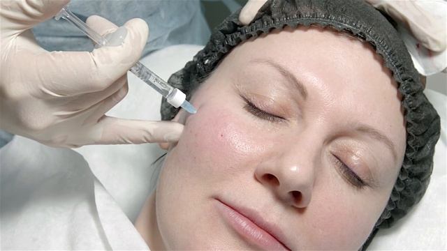 Filler Novacutan FBio Face Contour Correction Dr.Mozheiko