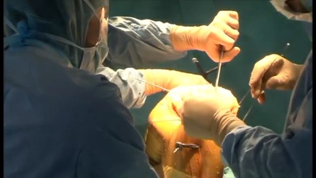 Chapter 25 - Orthopilot Knee Surgery
