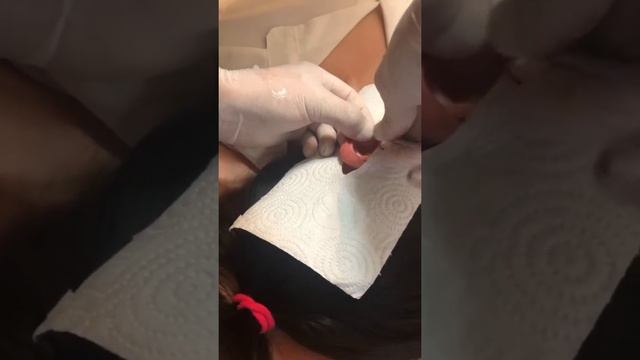 Прокол мочек. Получился очень интересный прокол?? смотреть онлайн