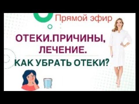 ❤️ ️ОТЕКИ. ПРИЧИНЫ, ЛЕЧЕНИЕ. КАК УБРАТЬ ОТЕКИ❓ Прямой эфир. Врач эндокринолог диетолог Ольга Павлова смотреть онлайн