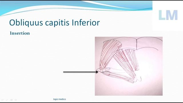 obliquus capitis inferior | Inferior oblique muscle | Anatomy | Origin, insertion, Nerve & actions смотреть онлайн