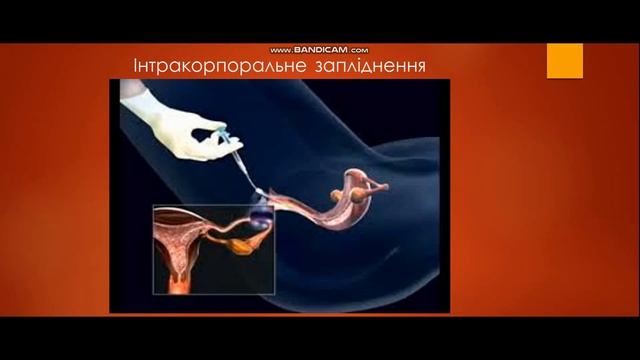 Біологія 10 клас. Особливості репродукції людини у зв'язку з її біосоціальною сутністю... смотреть онлайн