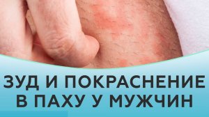 Зуд и покраснение в паху у мужчин