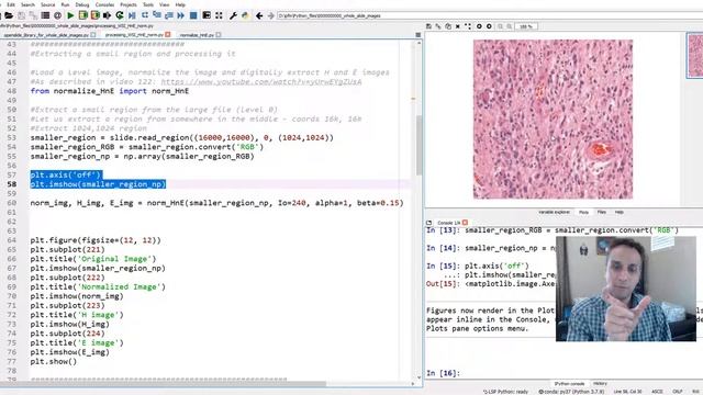 267 - Processing whole slide images (as tiles) смотреть онлайн