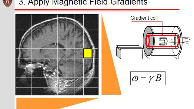 How does MRI work? смотреть онлайн