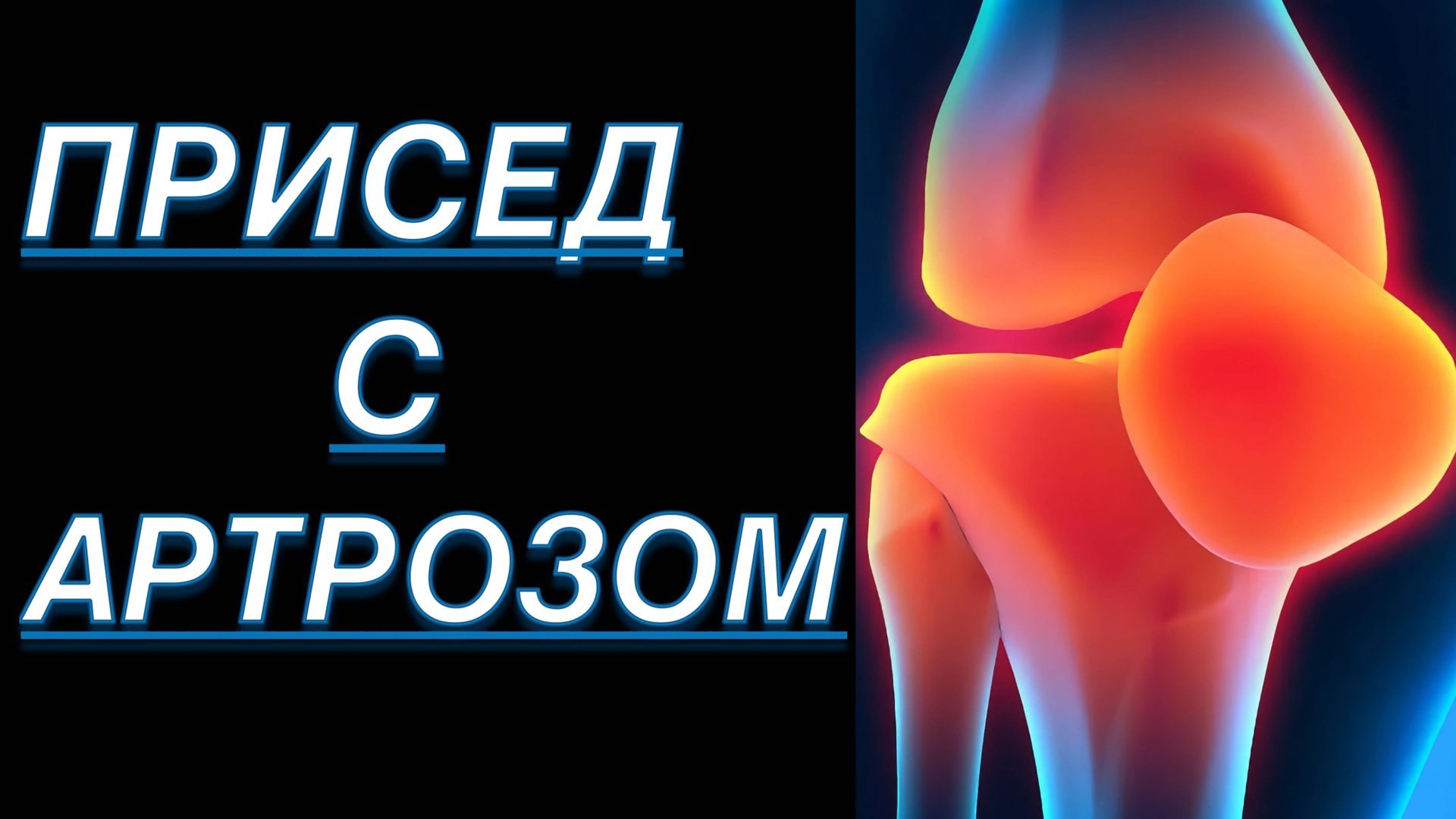 ПРИСЕДАНИЯ С АРТРОЗОМ КОЛЕННОГО СУСТАВА 3 СТЕПЕНИ смотреть онлайн