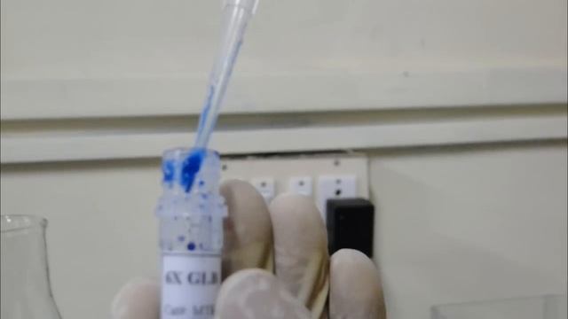 Agarose Gel Electrophoresis - Amrita University смотреть онлайн