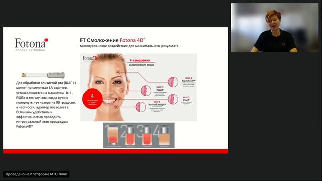 Вебинар 22.03.24. Fotona 4D PRO для многоуровневого лазерного омоложения лица смотреть онлайн