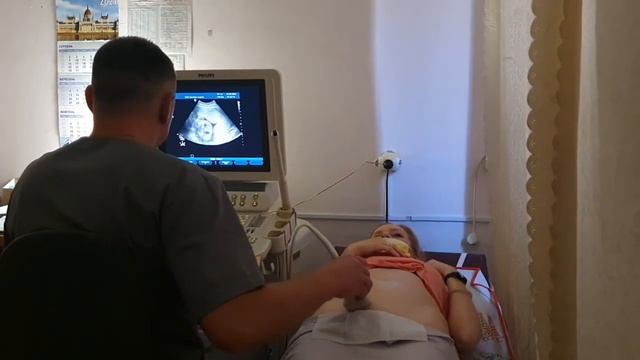 УЗИ 21-22 неделя. Узнаем пол ребенка ? 10.09 смотреть онлайн