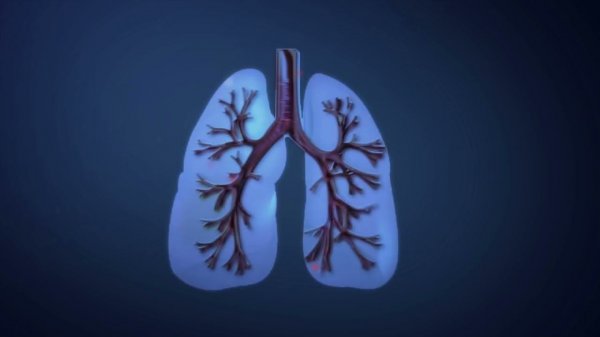 Симптомы туберкулеза