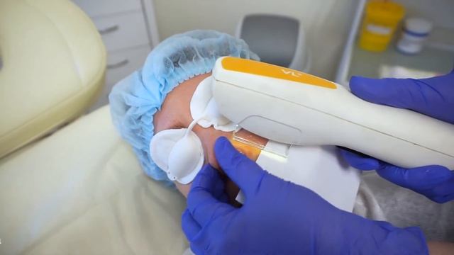 Избавление от пигмента и сосудов на долго смотреть онлайн