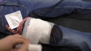 Мастер-класс "Первая помощь при открытом переломе бедра и  артериальном кровотечении"