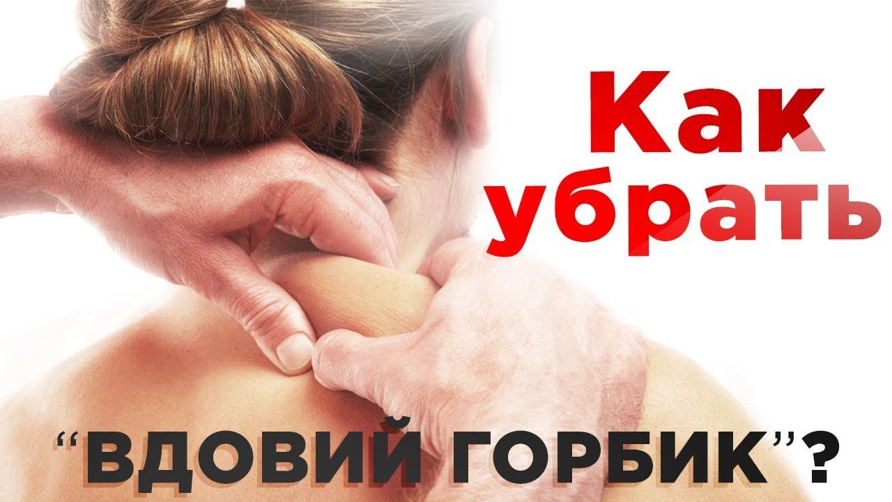 Как убрать вдовий горбик? Холка, шишка на шее - причины и методы лечения смотреть онлайн