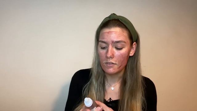 I Used The Ordinary AHA BHA Peeling Solution To Fade Out Acne Scars| *Before and After pictures* смотреть онлайн