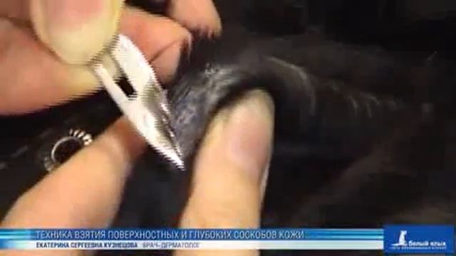 Техника взятия поверхностных и глубоких соскобов кожи смотреть онлайн