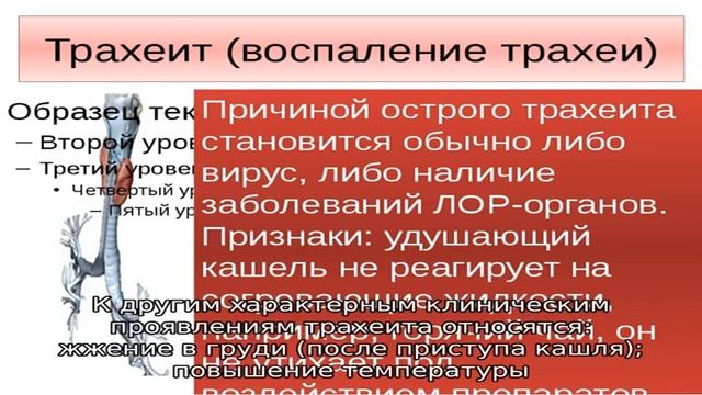 Трахеит у взрослых смотреть онлайн