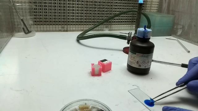 Fungal staining procedure | lactophenol cotton blue staining | staining techniques in microbiology смотреть онлайн
