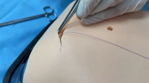 Косметический шов