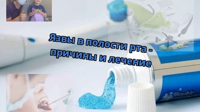 Язвы в полости рта - причины и лечение смотреть онлайн