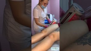 Обучение на аппарате эндосфера B50