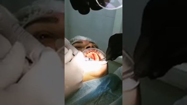 Использование клея "Сульфакрилат" в стоматологии смотреть онлайн