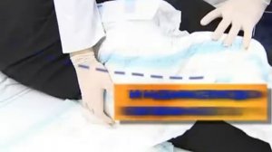 Как одеть подгузник на лежачего больного?