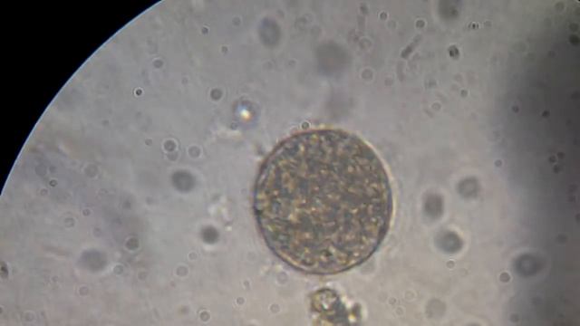 Яйцо паразита под микроскопом смотреть онлайн