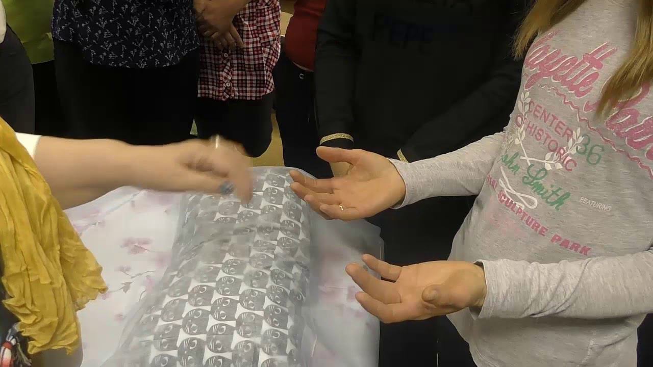 Контрактура Дюпюитрена. Диагностика ладоней смотреть онлайн