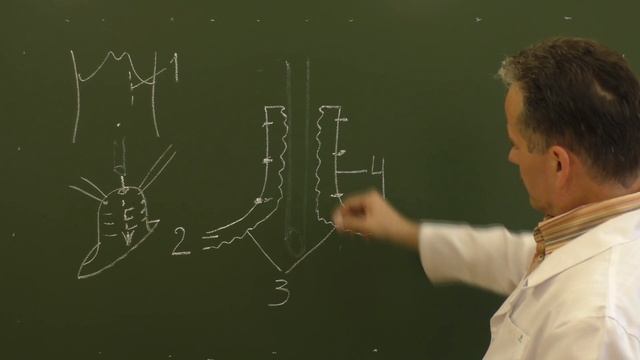 Схема желудочного свища по Топроверу смотреть онлайн