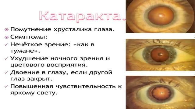 КАК САМОСТОЯТЕЛЬНО СДЕЛАТЬ СПЕЦИЮ - ИМЕРЕТИНСКИЙ ШАФРАН. смотреть онлайн