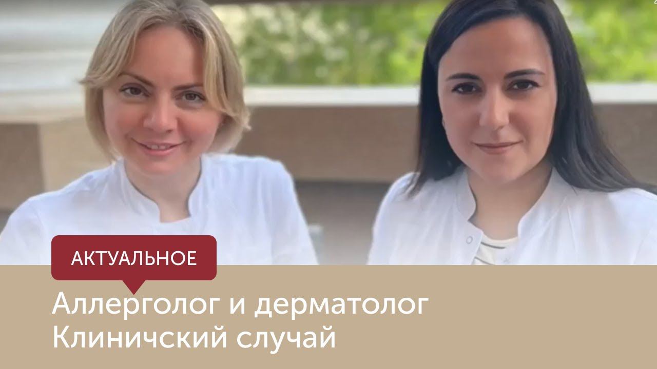 Аллерголог и дерматолог - клинический случай смотреть онлайн