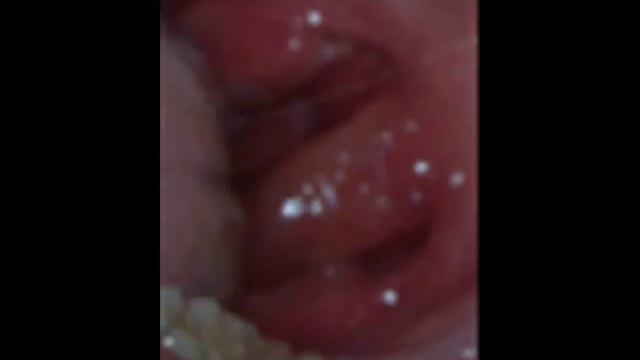 Guinness World Record 2012 Human Biggest Clitoris