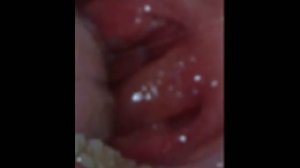 Guinness world record 2012 human biggest clitoris