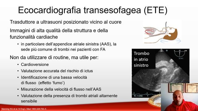 Fibrillazione atriale - VECCHIO VIDEO AA 2019/2020 смотреть онлайн