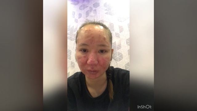 Арьсаа хэрхэн эмчлэх вэ? смотреть онлайн