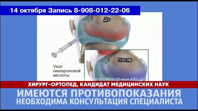 Как решить проблему с суставами