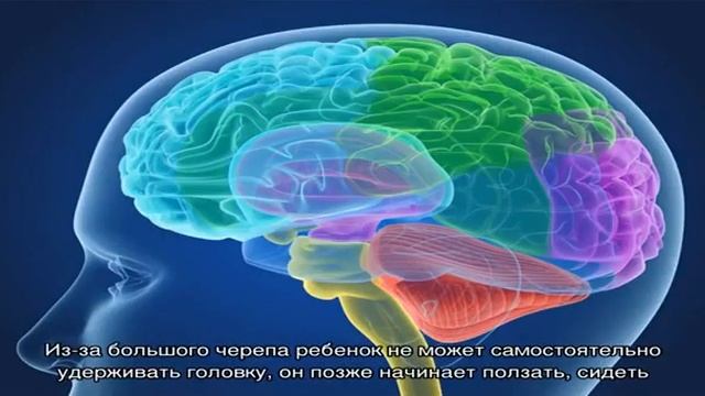 Гидроцефалия головного мозга у детей смотреть онлайн