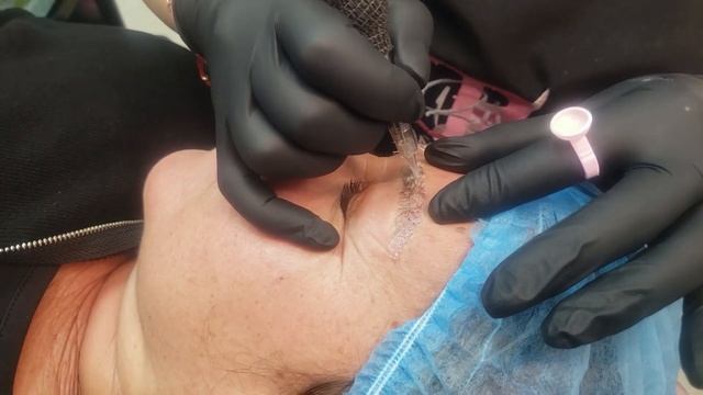 Remoción De Pigmentación Mal Realizada En Cejas, Tatuajes, Maquillaje Semipermanente Natural Y Lase
