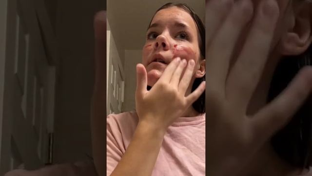 First time using : The Ordinary Peeling Solution https://amzn.to/3DrRQcB смотреть онлайн