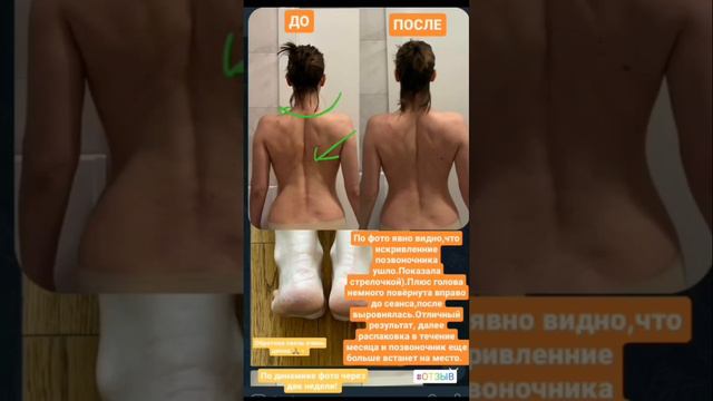 Энергетическое выравнивание позвоночника смотреть онлайн