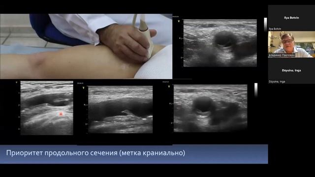 Сосудистая школа GE Healthcare. Артерии нижних конечностей (АНК). Сессия №3