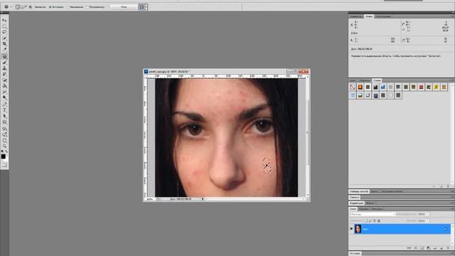 Как убрать прыщи в фотошопе cs5 смотреть онлайн