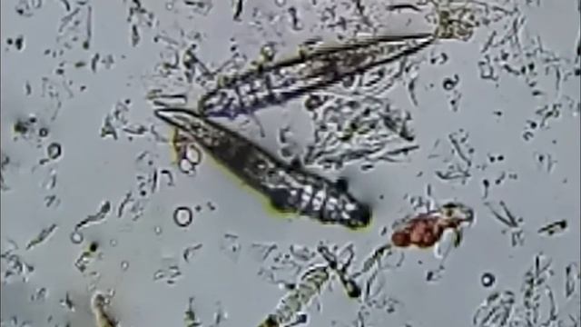 Демодекоз у собаки. смотреть онлайн