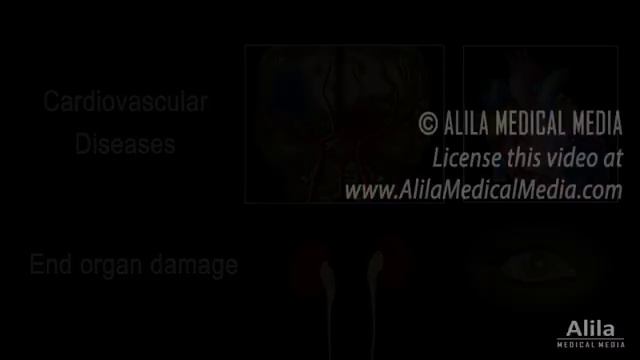 Hypertension - High Blood Pressure, Animation