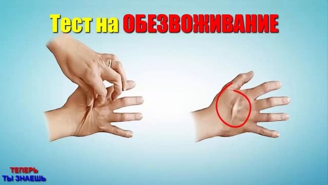 УЩИПНИТЕ Себя За РУКУ и Отпустите! Простой ТЕСТ На ОБЕЗВОЖИВАНИЕ Организма! смотреть онлайн