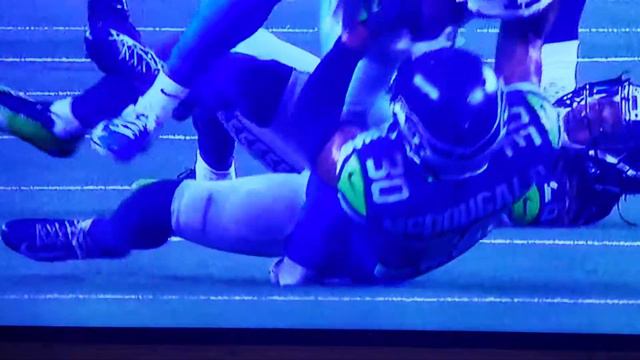 Cowboys WR Allen Hurns Suffers Gruesome Ankle Injury In Playoff Game смотреть онлайн