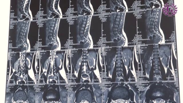 МРТ смотреть онлайн