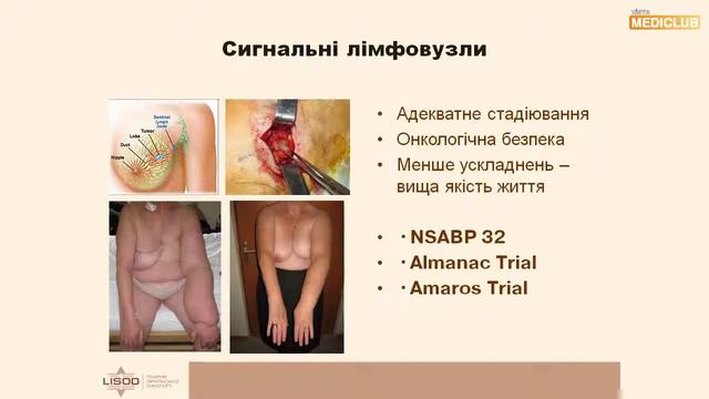 Рак молочной железы. Изменение концепции и современные аспекты лечения смотреть онлайн