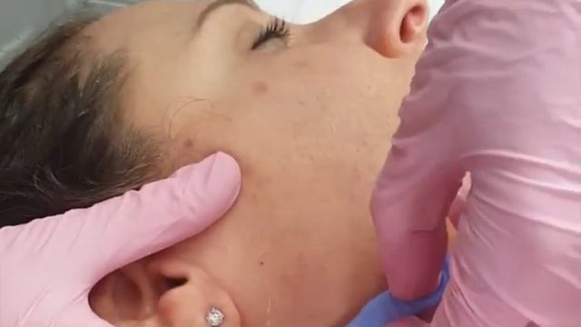 Dermaplaning Exfoliation Facial | Dermaplaning At Home - StackedSkincare смотреть онлайн