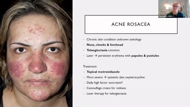 Common Dermatology for Finals смотреть онлайн